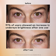 Brighten-Up Hydrogel Undereye Patches